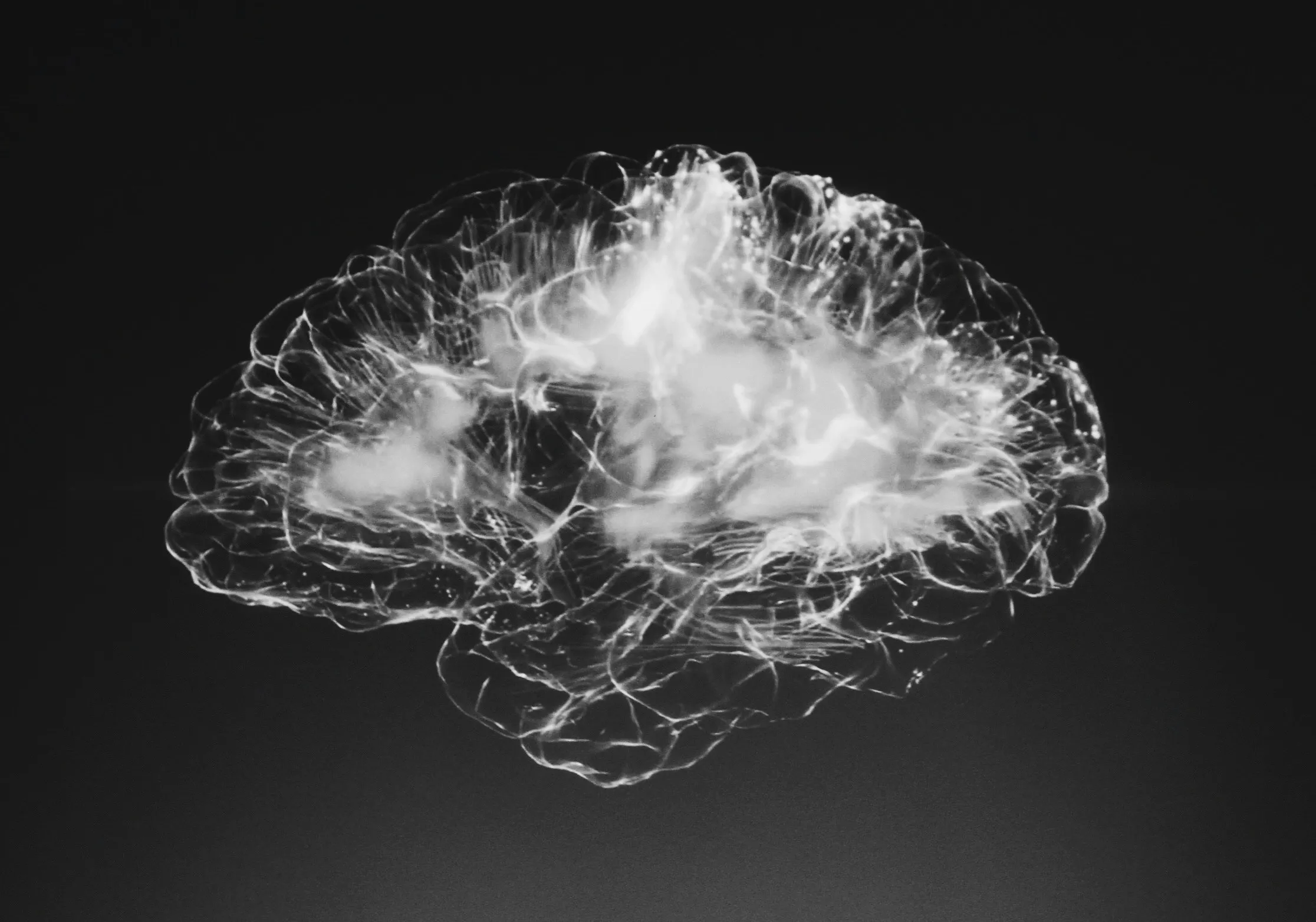 Information Pathways in Brain, photo by Alina Grubnyak An image of a brain scan.